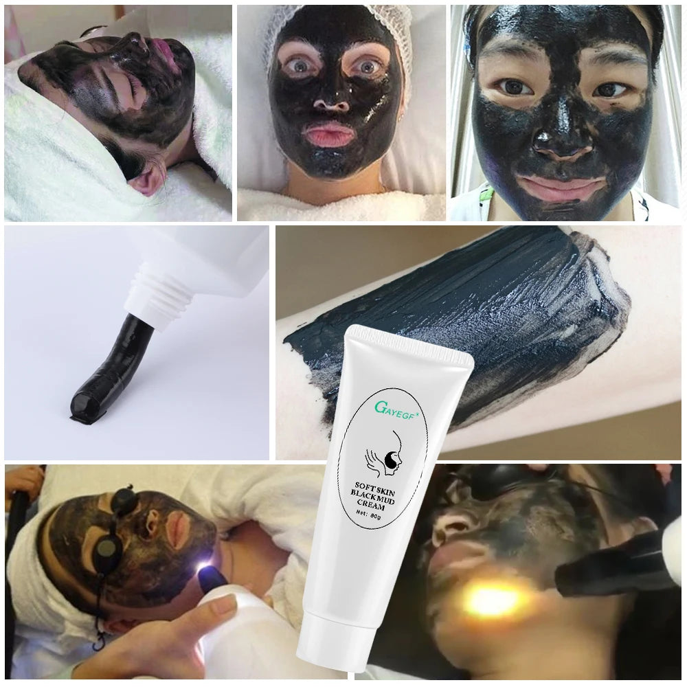Carbon Laser Facial Gel for Skin Rejuvenation and Deep Pore Cleansing