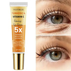 YUITIKUE Turmeric Vitamin C Eye Cream for Dark Circles and Firming