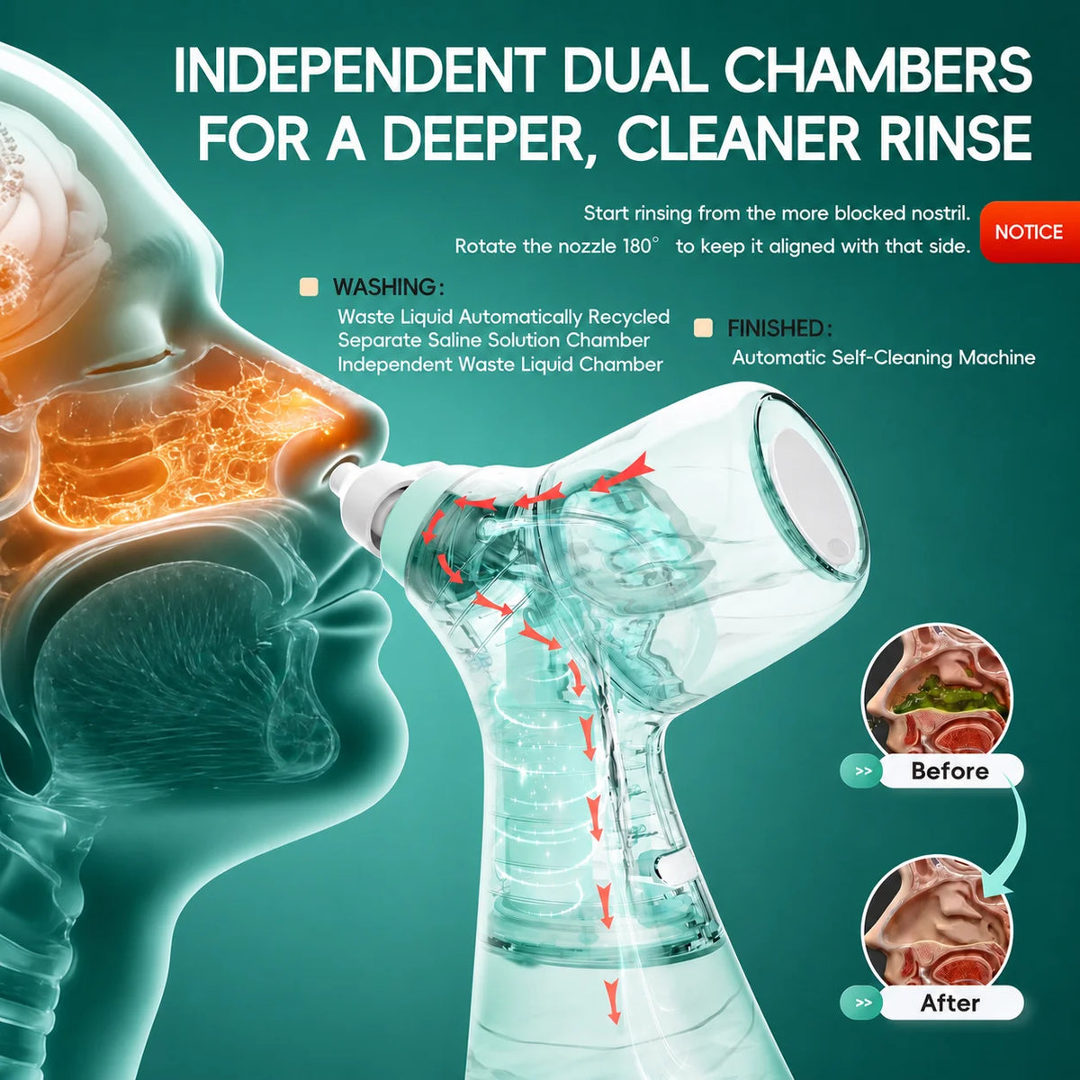 Electric Nasal Irrigator for Sinus Relief and Congestion