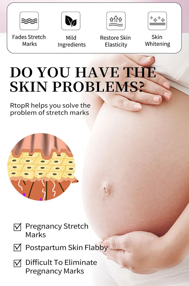 Mango Stretch Mark Cream and Repair Oil for Maternity Skin Care