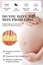 Mango Stretch Mark Cream and Repair Oil for Maternity Skin Care
