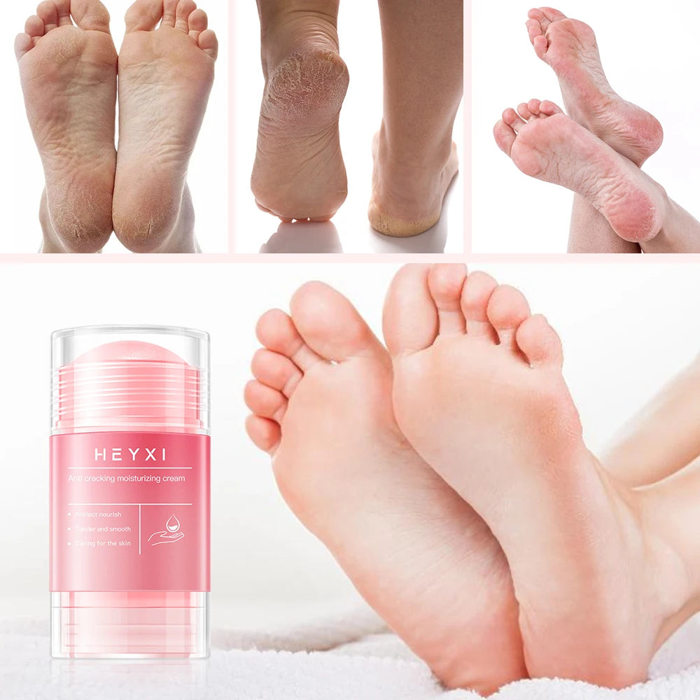 Heyxi Anti Cracking Foot Cream Moisturizing Heel Repair Balm