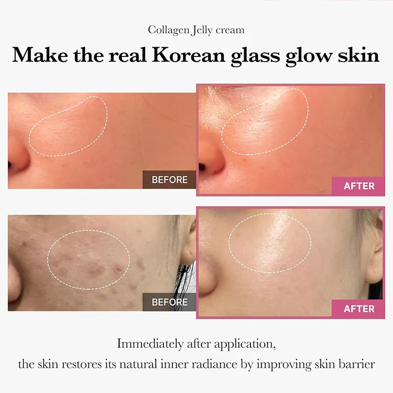 Water Ice Levin Collagen Jelly Stick Face and Neck Tightening Cream