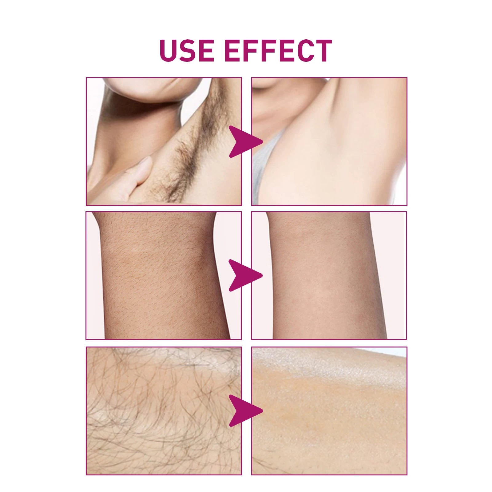 Painless Hair Removal Cream for Sensitive Skin - 4