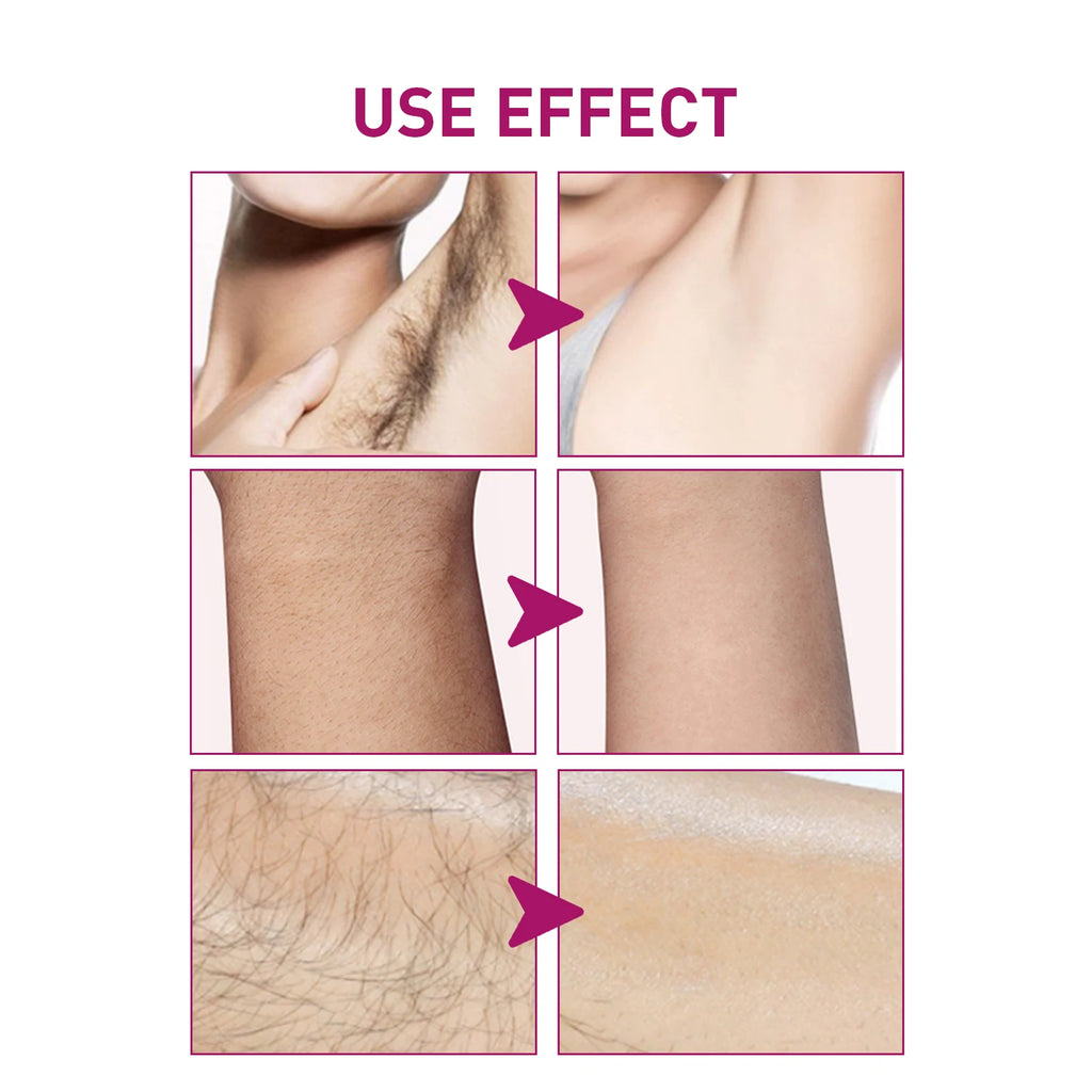 Painless Hair Removal Cream for Sensitive Skin