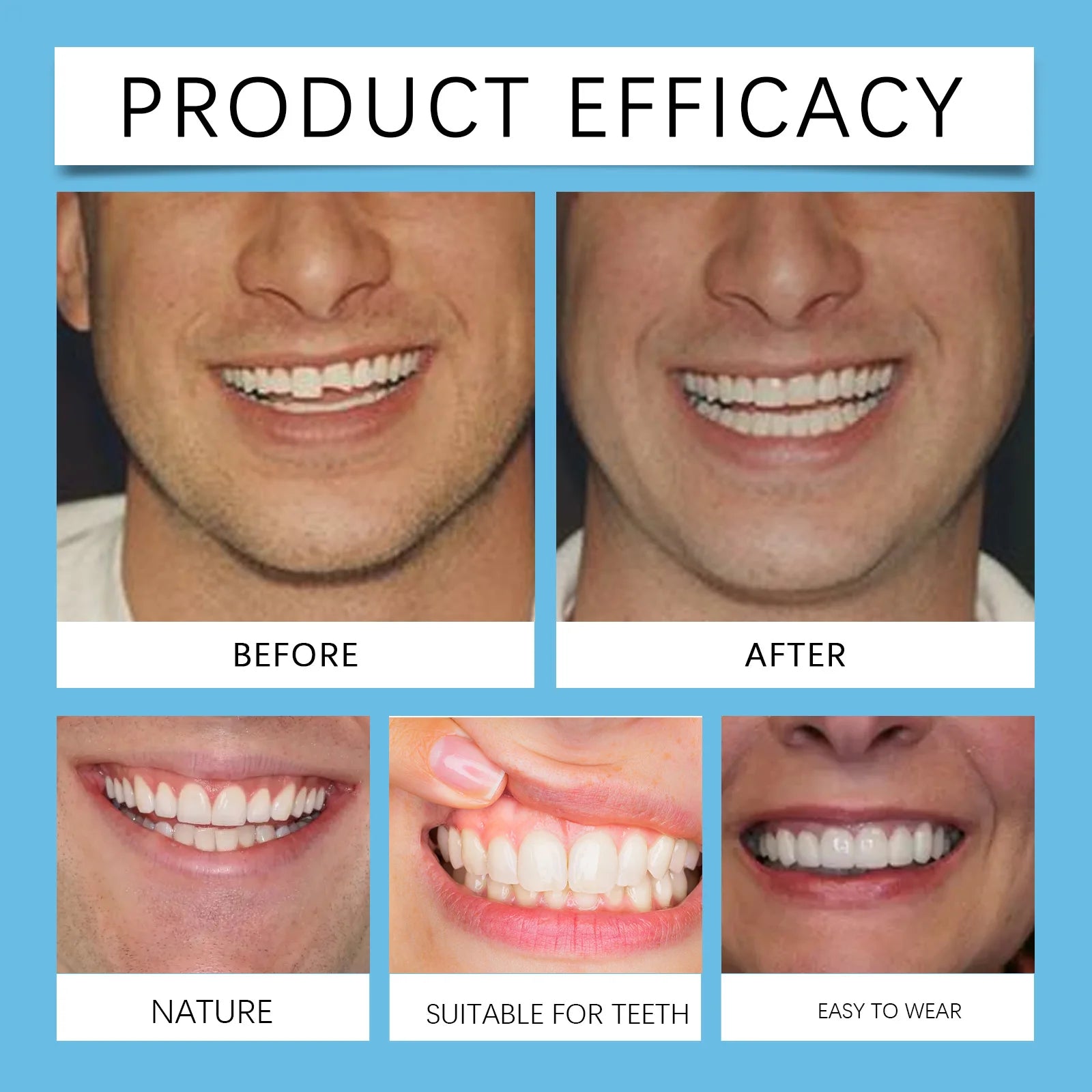 Temporary Silicone Denture Set for Smile Restoration - 19