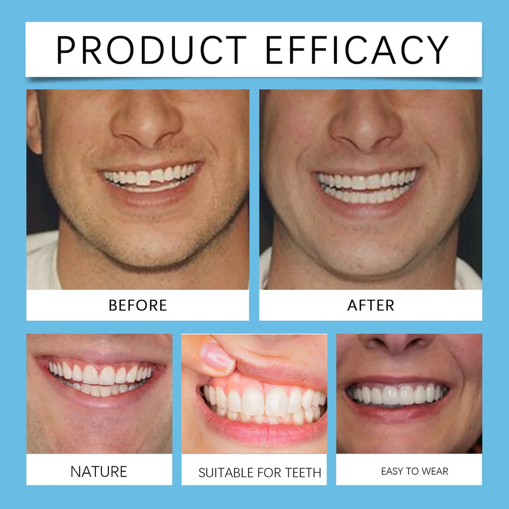 Temporary Silicone Denture Set for Smile Restoration