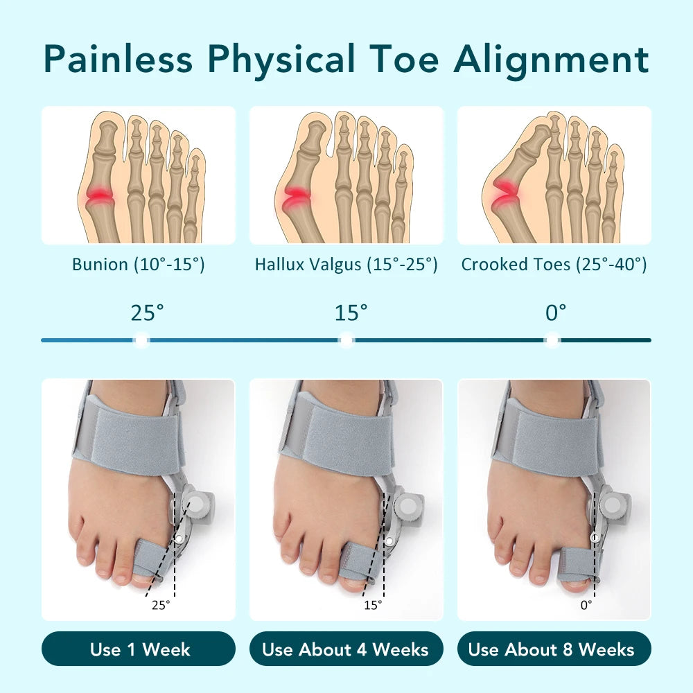 Adjustable Bunion Corrector for Hallux Valgus Pain Relief