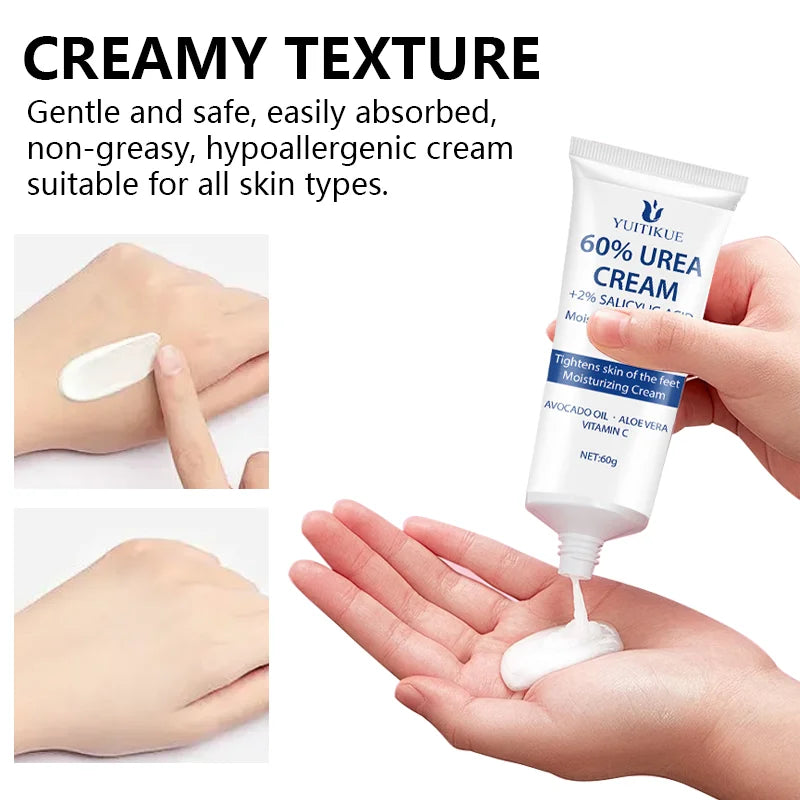 YUITIKUE 60% Urea Foot Repair Cream for Dry Cracked Skin 60g - 5