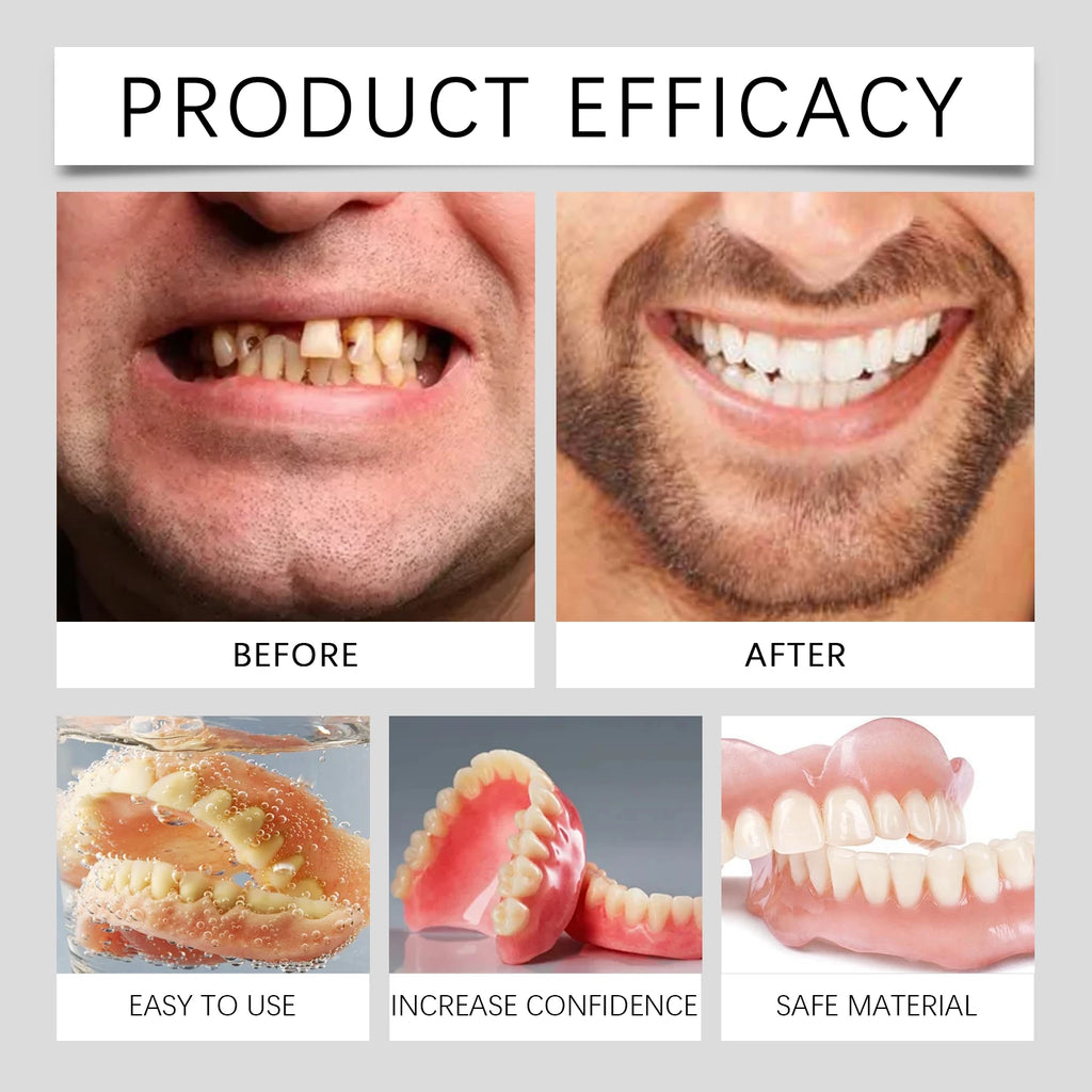 Temporary Cosmetic Denture Set for Smile Improvement