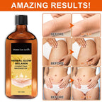 Herbal Glow Melanin Correcting Massage Oil Brightening Body Treatment