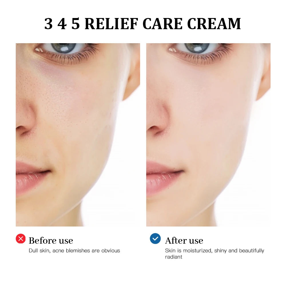 Daily Barrier Relief Moisturizing Cream for Acne Prone Skin - 3
