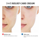 Daily Barrier Relief Moisturizing Cream for Acne Prone Skin