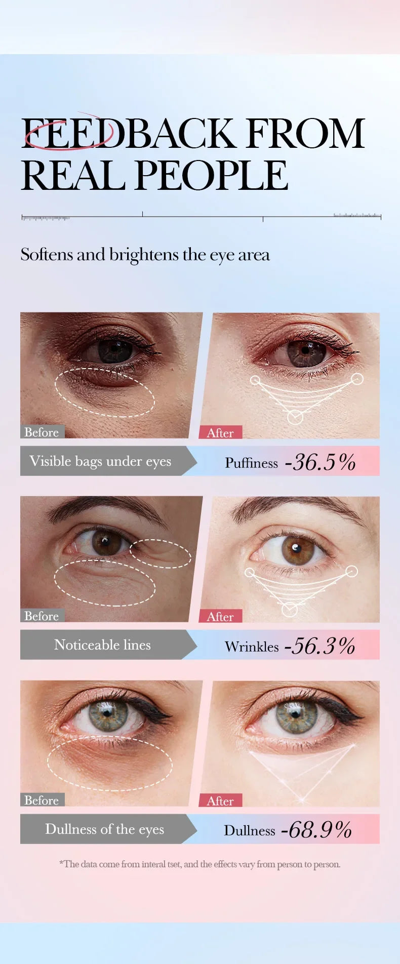 Retinol Anti-Aging Eye Cream for Dark Circles and Puffiness