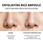 Exfoliating Rice Facial Essence for Brightening and Pore Refining