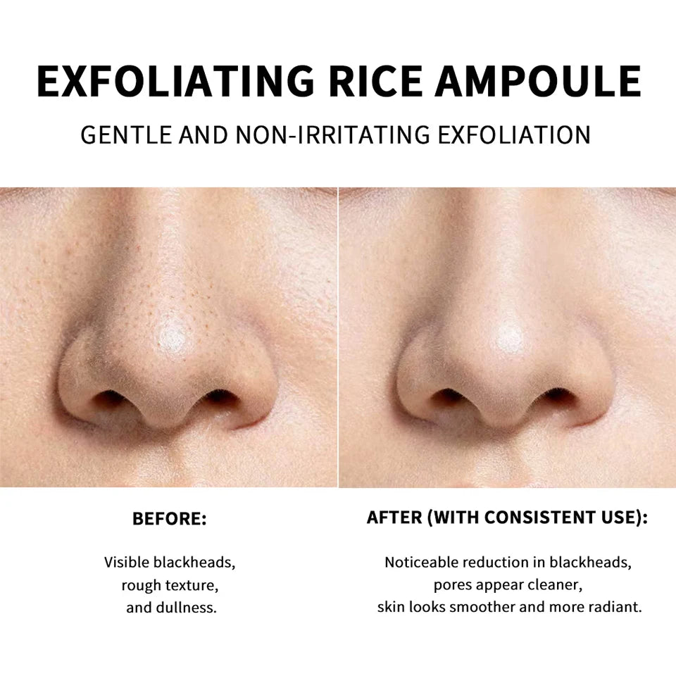 Exfoliating Rice Facial Essence for Brightening and Pore Refining