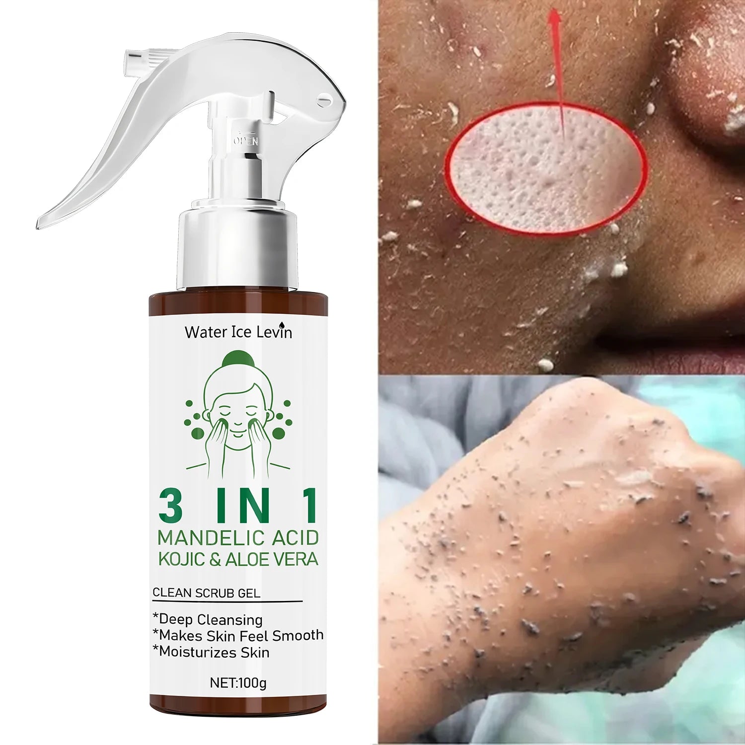 3 in 1 Mandelic and Kojic Acid Face Scrub Gel Exfoliating Cleanser - 1