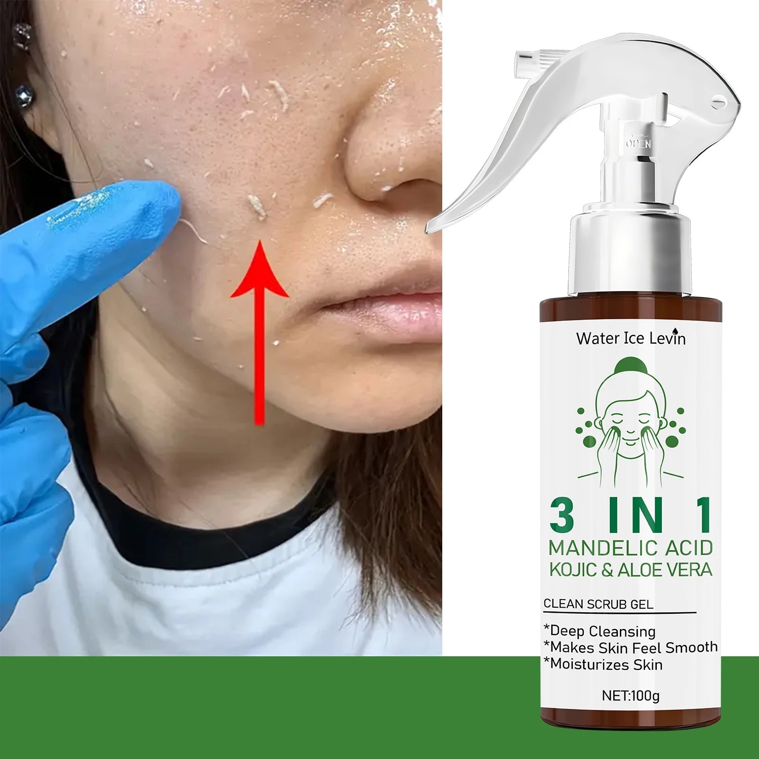 3 in 1 Mandelic and Kojic Acid Face Scrub Gel Exfoliating Cleanser - 5