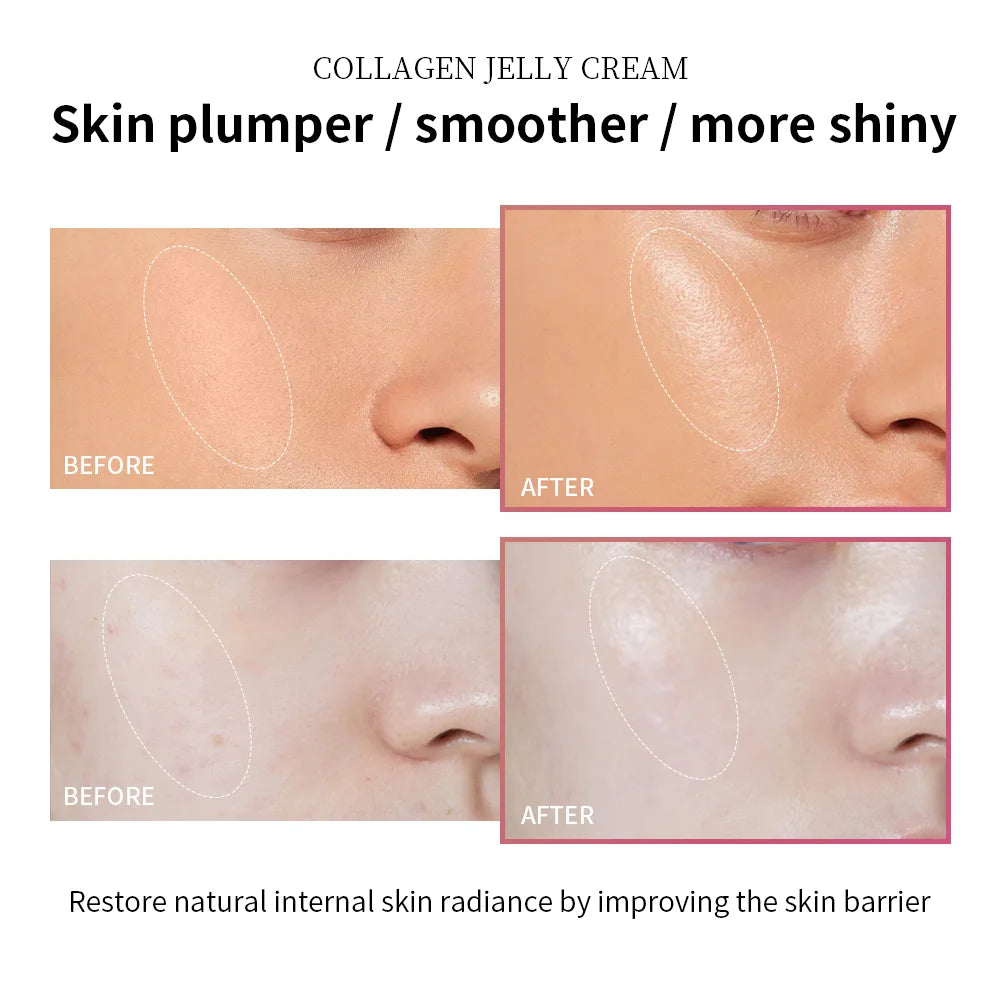 Collagen Jelly Face Cream for Skin Firming and Hydration - 4
