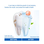 SP Probiotic Teeth Whitening Toothpaste Stain Removal and Breath Freshener