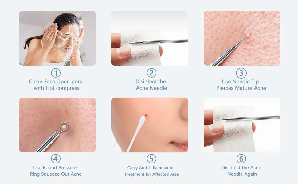 Professional Stainless Steel Blackhead and Pimple Extractor Tool Kit