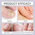 Nourishing Nail Repair Oil Pen for Damaged and Brittle Nails