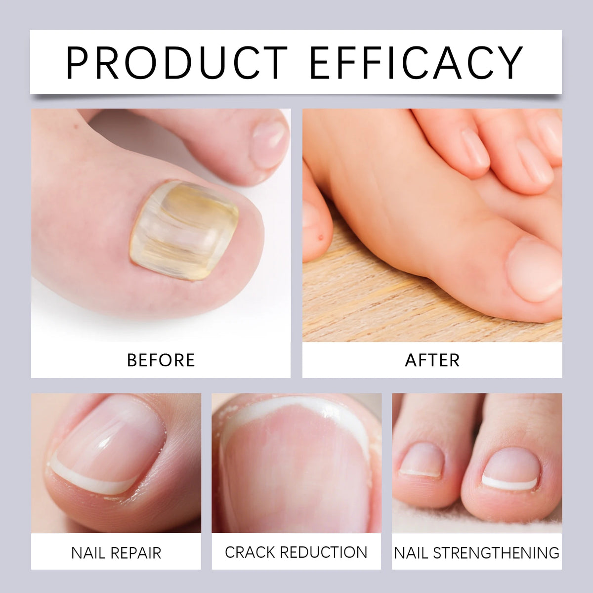 Nourishing Nail Repair Oil Pen for Damaged and Brittle Nails