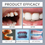 Comfort Fit Silicone Dentures for Natural Smile