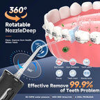 Portable Cordless Water Flosser for Teeth and Braces