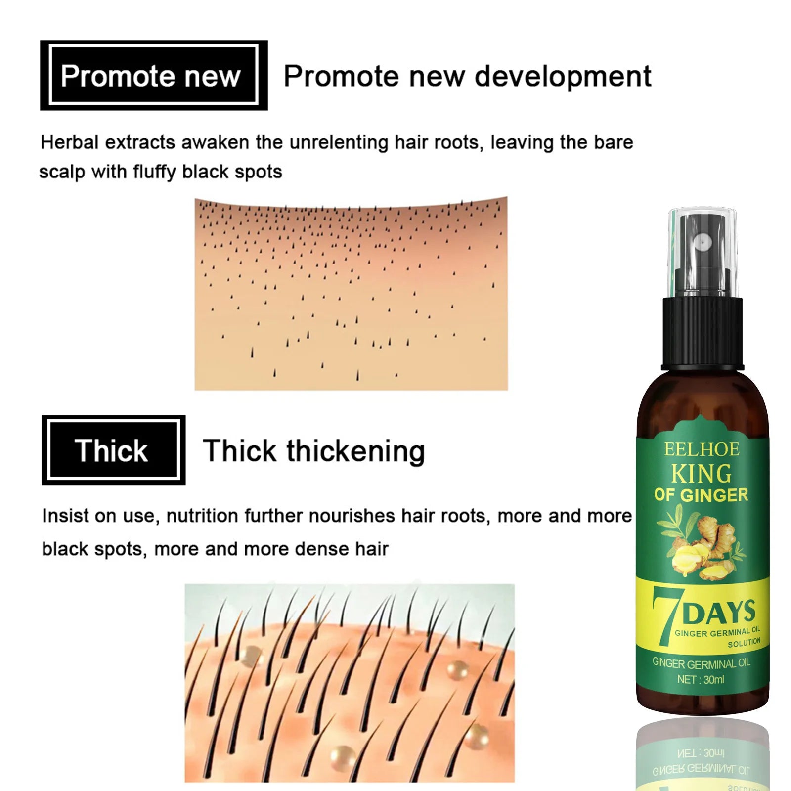 Ginger Hair Growth Spray Scalp Moisturizing Repair Treatment 30ml - 5