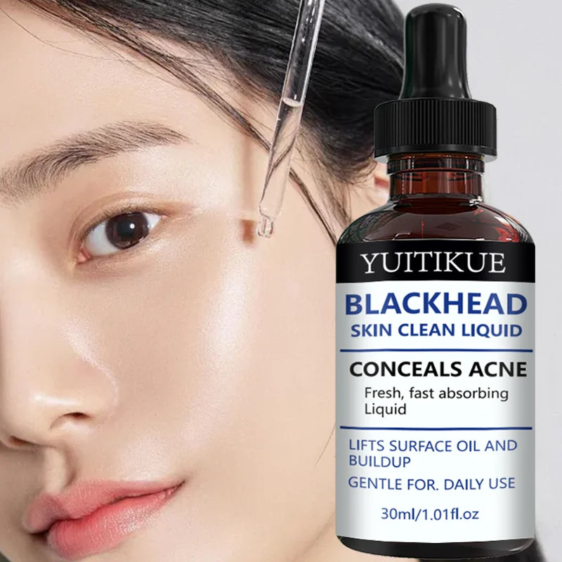 YUITIKUE Blackhead Remover Serum Pore Refining Face Treatment 30ml - 9