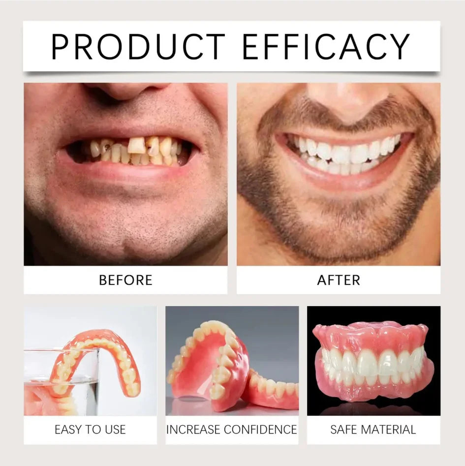 Instant Smile Cosmetic Dentures for Full Mouth