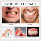 Instant Smile Cosmetic Dentures for Full Mouth