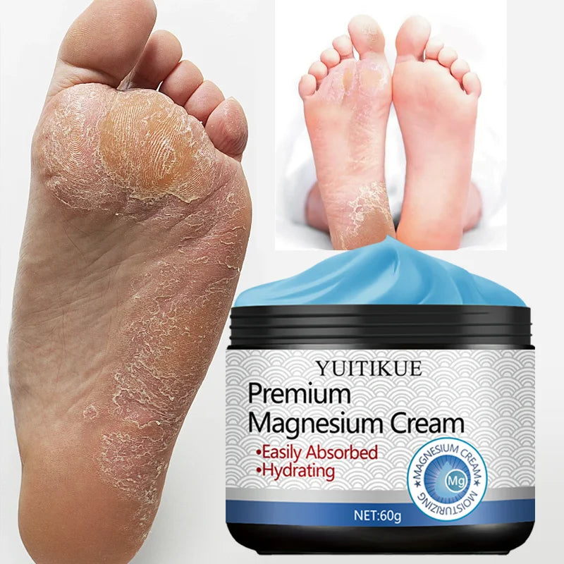 YUITIKUE Magnesium Cream Fast Absorbing Moisturizer for Hands and Feet