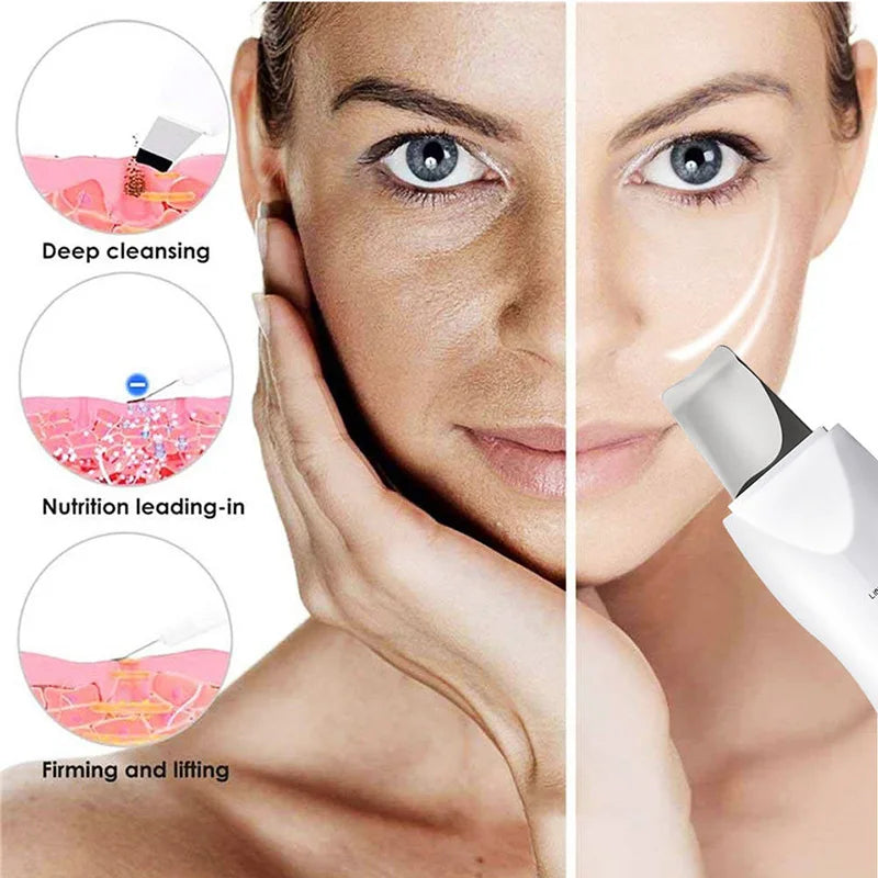 Ultrasonic Skin Scrubber Facial Pore Cleaner Blackhead Remover Device - 10