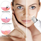 Ultrasonic Skin Scrubber Facial Pore Cleaner Blackhead Remover Device