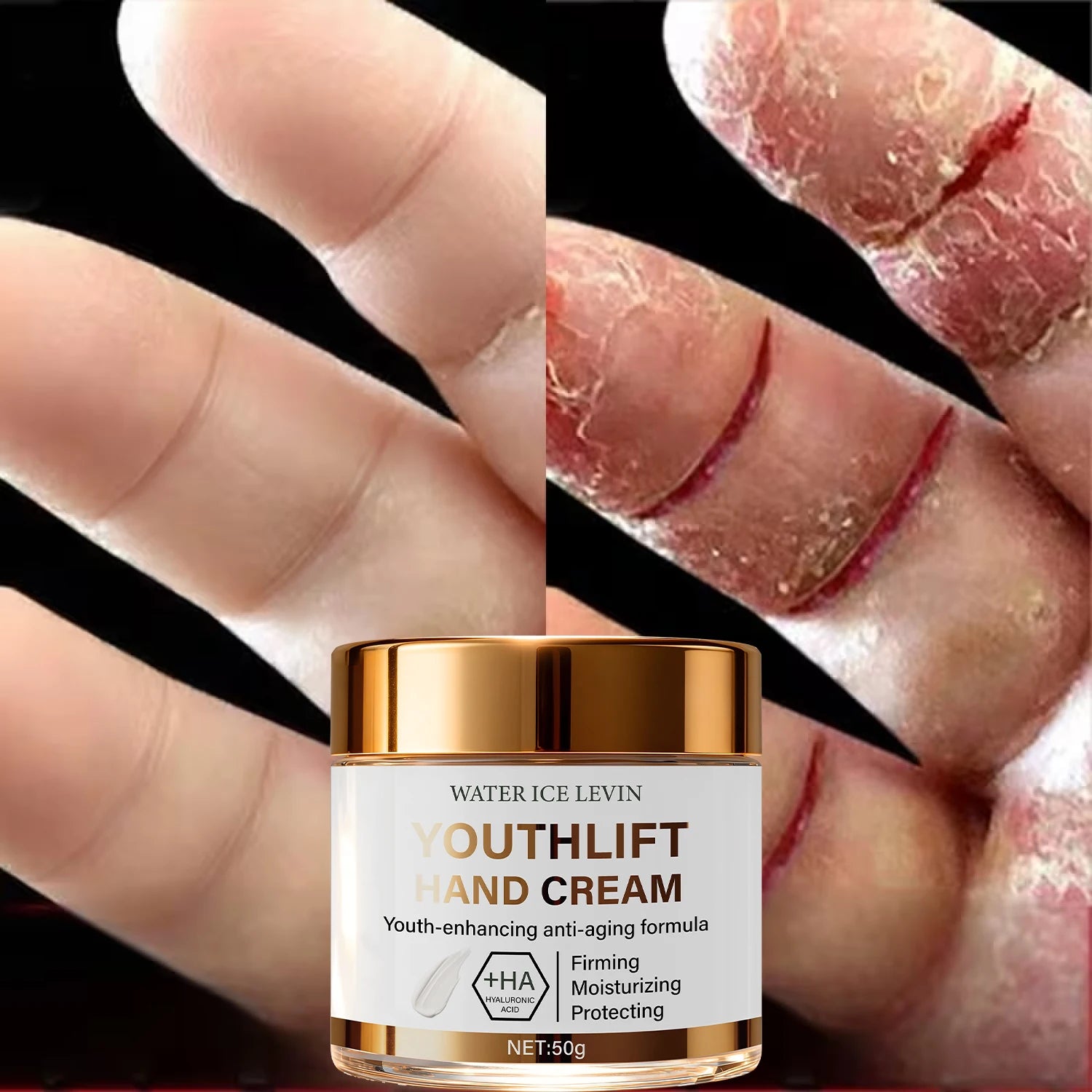 YouthLift Anti-Aging Hand Cream with Retinol and Hyaluronic Acid - 1