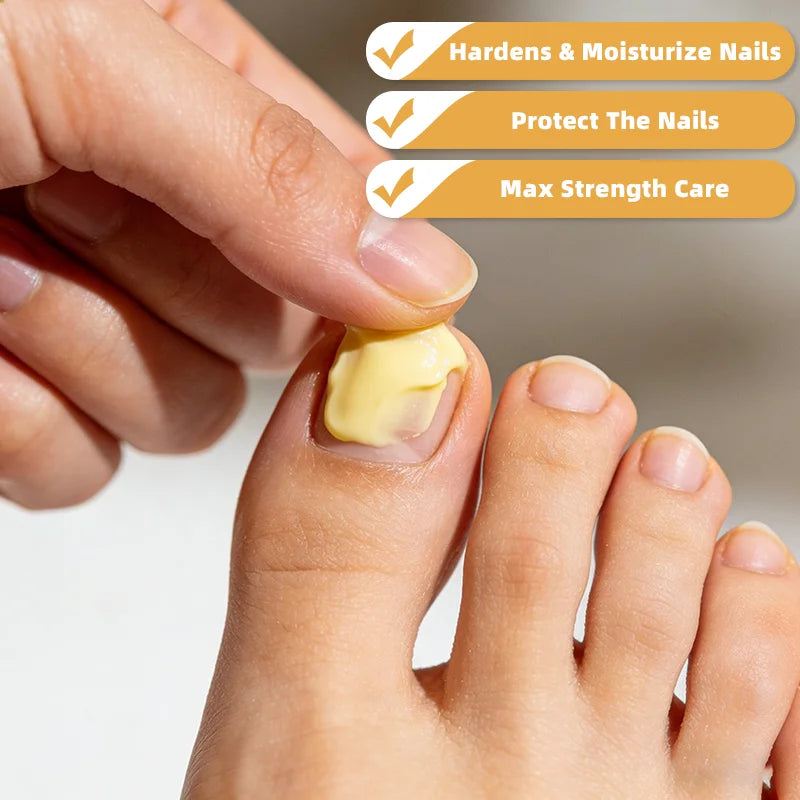 YUITIKUE Bee Venom Nail Repair Cream - Strengthening Nail Care Treatment