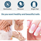 YUITIKUE Ginger Nail Repair Cream 60g Cuticle Nourishing Treatment