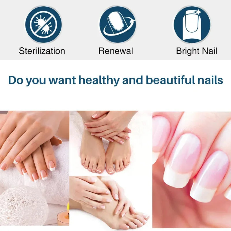 YUITIKUE Ginger Nail Repair Cream 60g Cuticle Nourishing Treatment