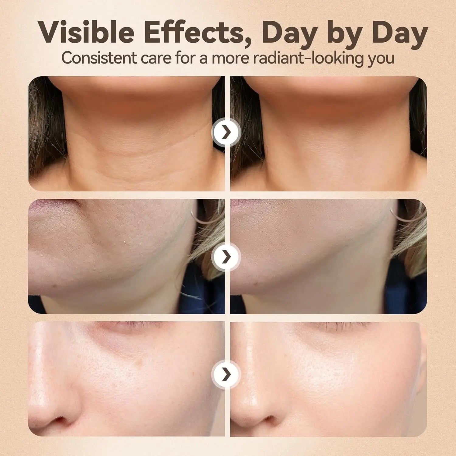 3-in-1 LED Facial Massager for Skin Tightening and Lifting - 4