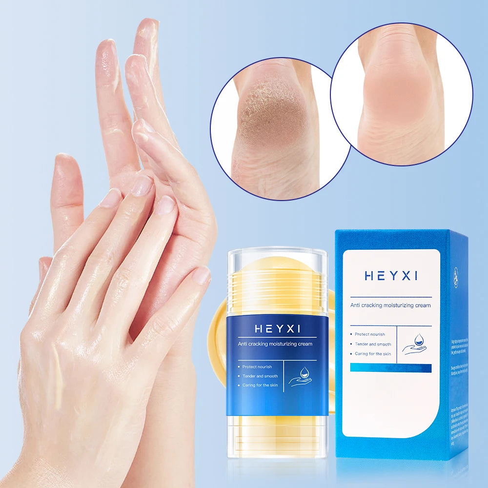 Heyxi Moisturizing Repair Balm Anti Cracking Cream for Hands and Feet