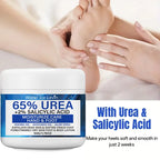 Urea 65 Percent Foot Cream Salicylic Acid Moisturizing Exfoliating Balm