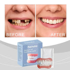 Temporary Silicone Cosmetic Dentures for Missing Teeth