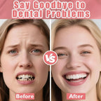 Realistic Temporary Denture Set for Comfortable Smile