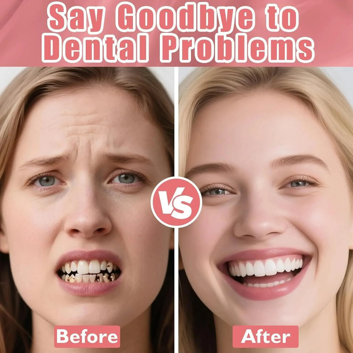 Realistic Temporary Denture Set for Comfortable Smile