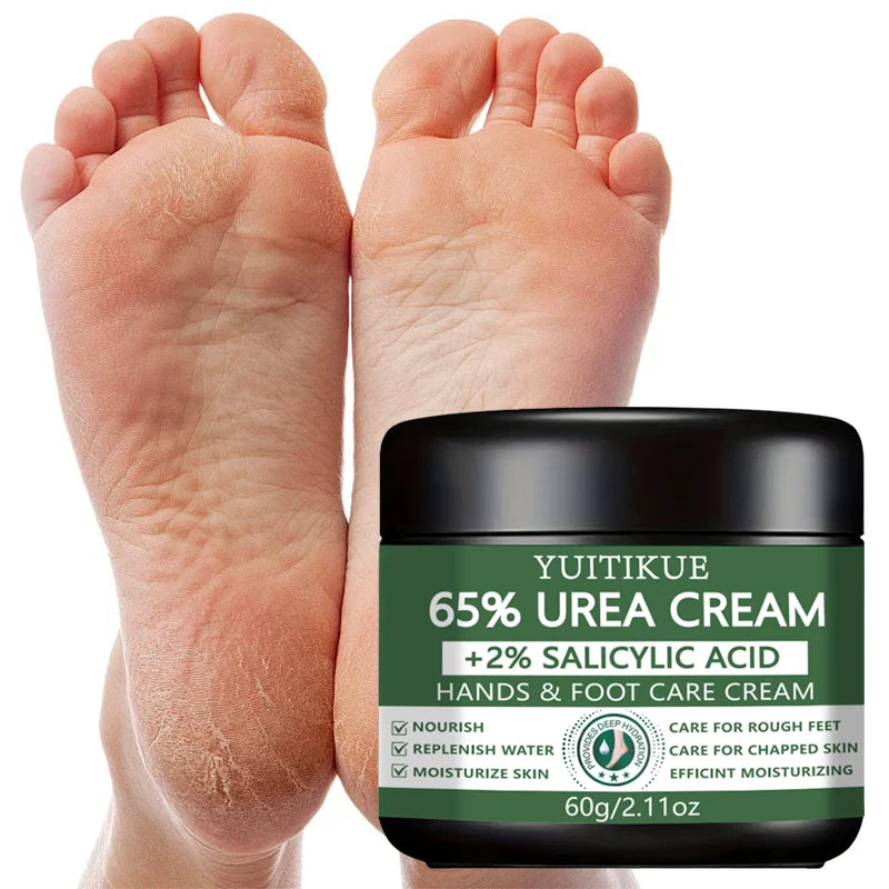 65% Urea Cream with Salicylic Acid for Rough Dry Hands and Feet 60g - 2