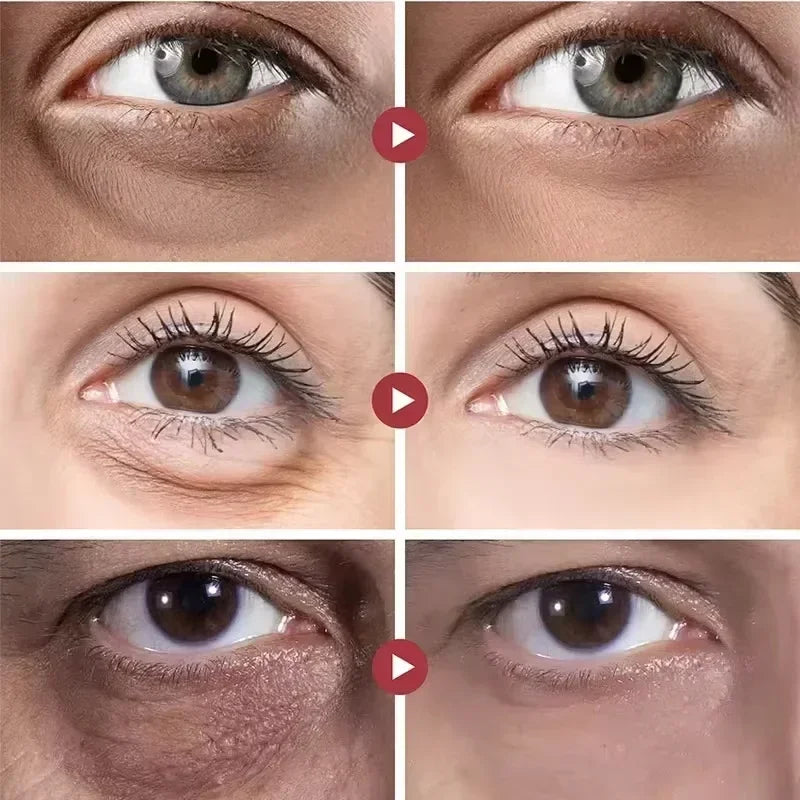 Retinol Anti-Aging Eye Cream for Dark Circles and Puffiness