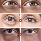 Retinol Anti-Aging Eye Cream for Dark Circles and Puffiness