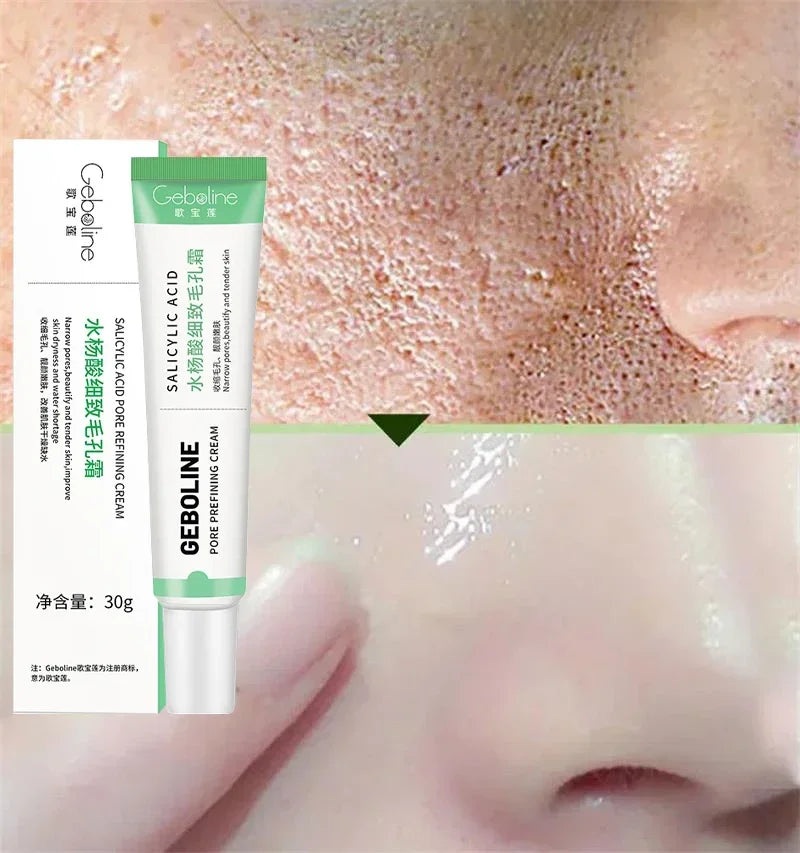 Salicylic Acid Pore Refining and Acne Repair Cream